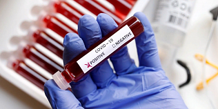 В Алтайском крае за минувшие сутки зарегистрировано 38 новых случаев заболевания коронавирусной инфекцией