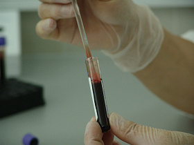 Барнаульцев приглашают бесплатно проверить здоровье и сдать анализ крови